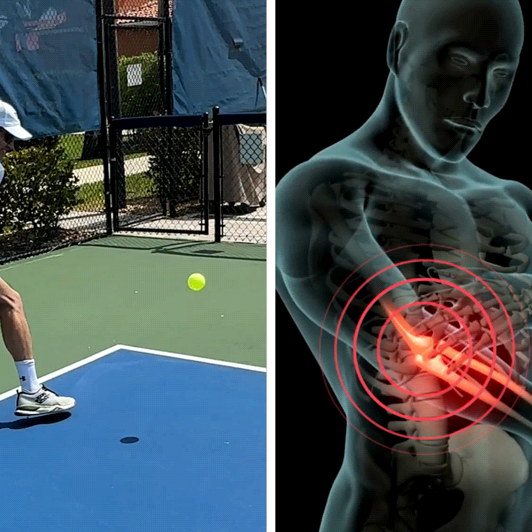 What really happens to your elbow while playing?